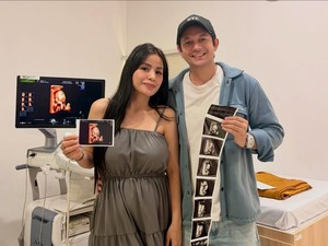 Kebahagiaan Andrew Andika Menanti Kelahiran Anak Perempuan dari Violentina Kaif