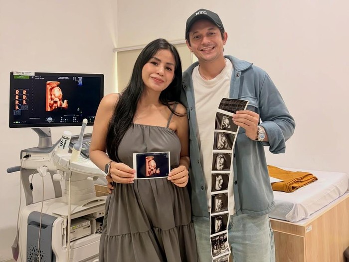 Andrew Andika umumkan istri hamil.