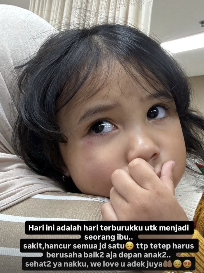 Azzura anak Aurel dan Atta Halilintar jatuh dari ketinggian.