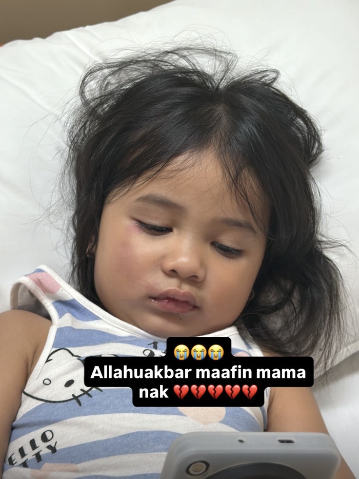 Azzura anak Aurel dan Atta Halilintar jatuh dari ketinggian.