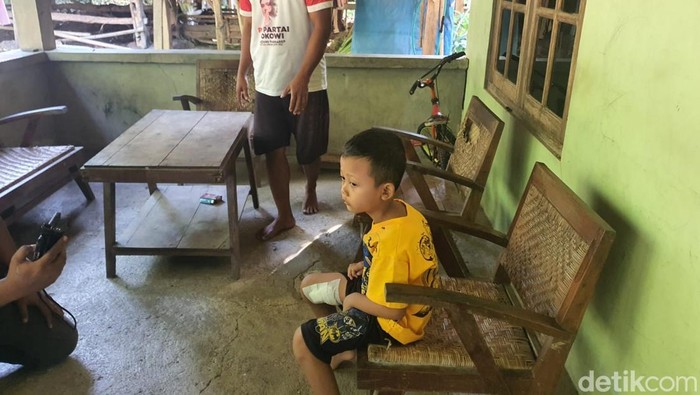 Salah satu korban serangan beruk yang lepas dari penangkaran BKSDA di Bunder, Playen, Gunungkidul, Selasa (9/6/2026).