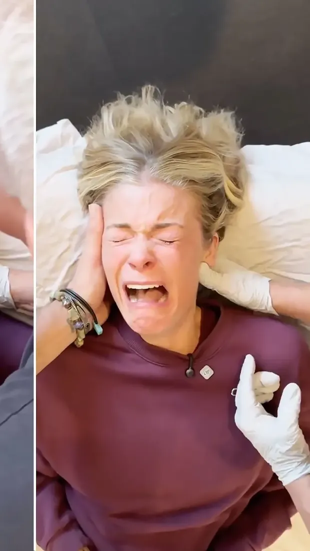 LeAnn Rimes terapi rahang LeAnn Rimes terapi rahang