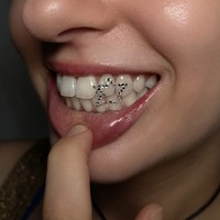 Gigi Kini Punya Aksesorinya, Tren Tooth Gem Viral di Kalangan Gen Z