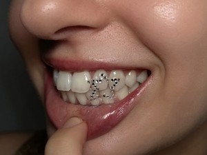 Gigi Kini Punya Aksesorinya, Tren Tooth Gem Viral di Kalangan Gen Z
