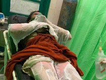 Kondisi Siti Jalani Operasi Kedua Usai Dibakar Mantan Suami Siri