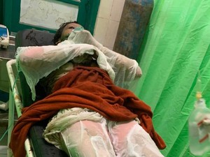 Kondisi Siti Jalani Operasi Kedua Usai Dibakar Mantan Suami Siri