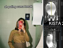 Perut Wanita di Bekasi Membesar, Ternyata Ada Kista Ovarium 29 Cm