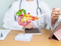 Dokter Harvard Ungkap Gejala Tersembunyi Kanker Pankreas yang Perlu Diwaspadai