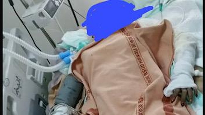 Begini Kondisi Terkini Siti Juhairiyah di ICU RS Hanau Masih Kritis