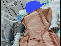 Siti Masih Kritis Usai Dibakar Mantan Suami, Perwakilan Keluarga Buka Suara
