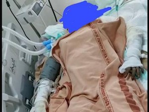 Siti Masih Kritis Usai Dibakar Mantan Suami, Perwakilan Keluarga Buka Suara