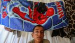 Bocah Palestina Menanti Mata Prostetik di Tengah Pengungsian Gaza