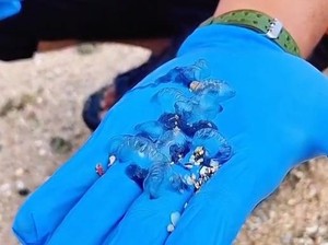 Korban Sengatan Ubur-ubur di Pantai Gunungkidul Mulai Berjatuhan