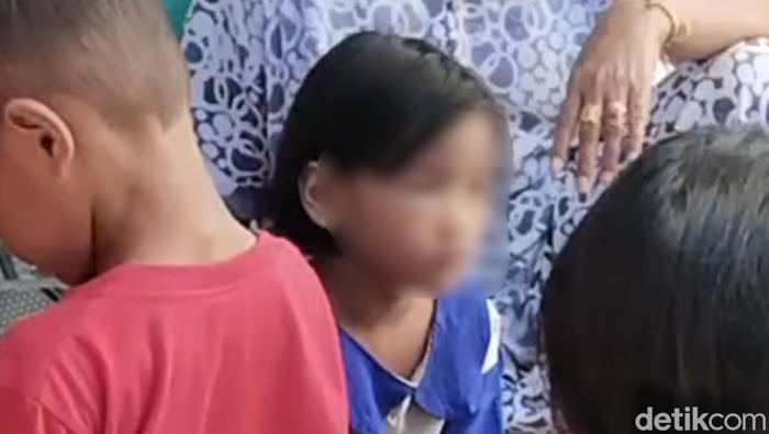 Wajah Bocah 5 Tahun di Kobar Lebam-lebam, Diduga Dianiaya Ibu Tiri. (Sigit Pamungkas)