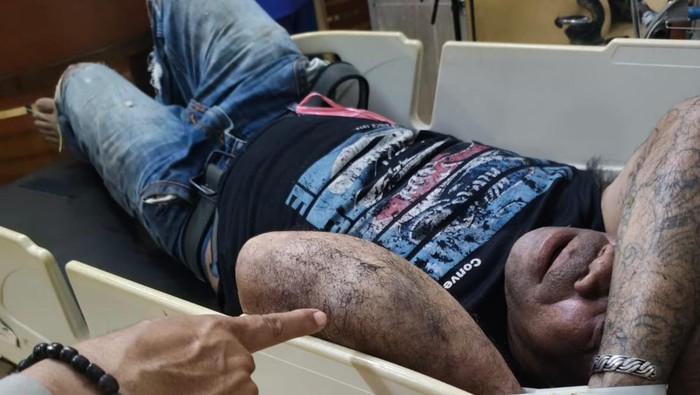 Pelaku penembakan tetangga di Samarinda dibawa ke RS setelah diamuk massa.