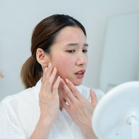 Apa Itu Melasma? Ini Pemicu Noda Gelap di Wajah dan Cara Tepat Mengatasinya
