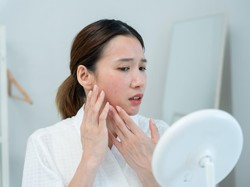 Apa Itu Melasma? Ini Pemicu Noda Gelap di Wajah dan Cara Tepat Mengatasinya