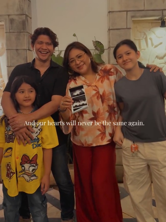 7 Potret Mesra Audy Item & Iko Uwais Anniversary ke-14, Umumkan Kehamilan