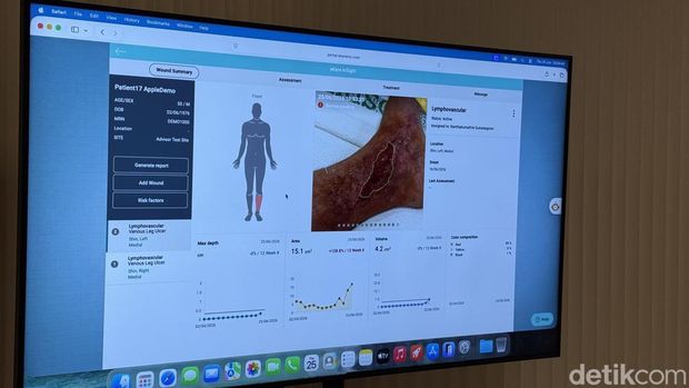Cerita Dokter dan Perawat Pakai Gadget Apple untuk Rawat Pasien