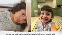 Seluruh keluarga selalu memberikan dukungan untuk setiap usaha yang dilakukan. Terapi makan ke sana ke mari. Sampai pernah lama tinggal sementara di Solo sama mami. Setiap kata yang akhirnya aku bisa ucapkan, setiap langkah dan target yang bisa aku capai, membuat orang tuaku lebih paham dan tahu arti syukur, paparnya. Foto: dok instagram Shireen Sungkar