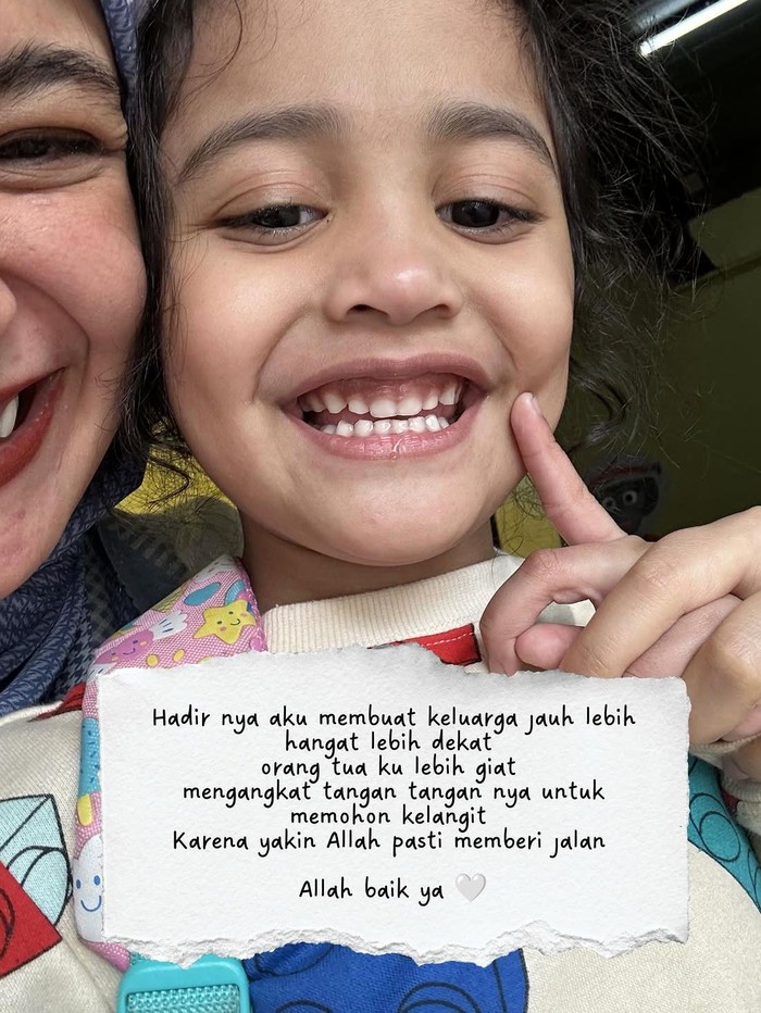 Semangat dan Doa Shireen Sungkar Dampingi Anak Idap Autisme