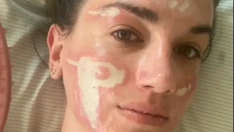 Niat Glow Up, Wanita Malah Alami Luka Bakar Permanen Usai Facial Mahal