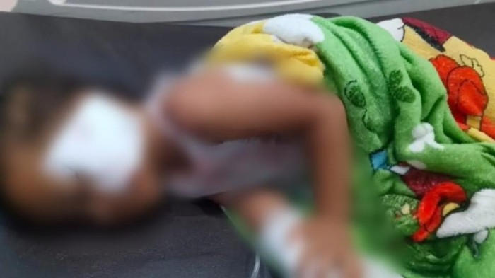 Balita di Kobar Diserang Monyet Lepas