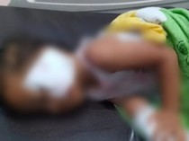 Balita di Kobar Diserang Monyet Lepas, Warga Murka ke Pemiliknya