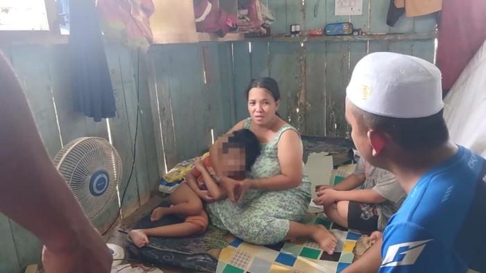 Bocah disabilitas di Samarinda yang patah tulang usai alami kejang.