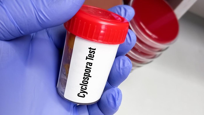 Technician holding a specimen container with stool sample for cyclospora test, to diagnosis of cyclosporiasis by examining under a microscope and finding oocysts.