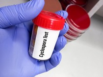 Video Wabah Cyclosporiasis Serang AS, Perubahan Kebijakan Kesehatan Disorot
