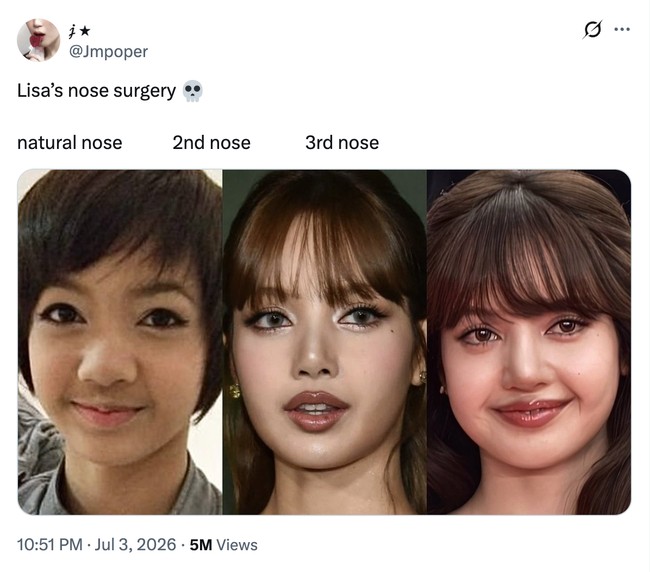 Tak sedikit yang salah fokus saat melihat side profile Lisa BLACKPINK. Tuduhan oplas hidung kembali mencuat setelah penampilannya di acara pembukaan Piala Dunia 2026 bulan lalu. Foto: dok. X