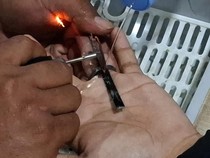 Awalnya Iseng, Jari Remaja di Kuningan Terjepit Ring Kopling Motor