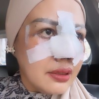 Melalui akun Instagram pribadinya Elly Sugigi membagikan perjalanan operasi plastik yang dilakukannya. Elly memilih melakukan operasi plastik di sebuah klinik kecantikan di Jakarta. Foto: Instagram/@ellysugigi_real