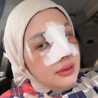 Potret Terbaru Elly Sugigi Setelah Oplas, Kini Berhidung Mancung