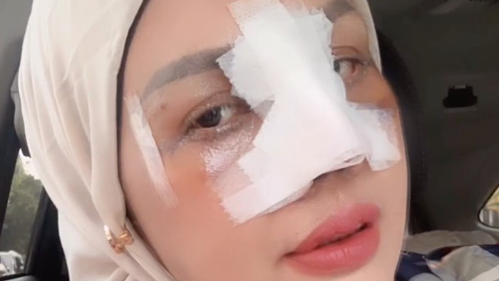 Elly Sugigi