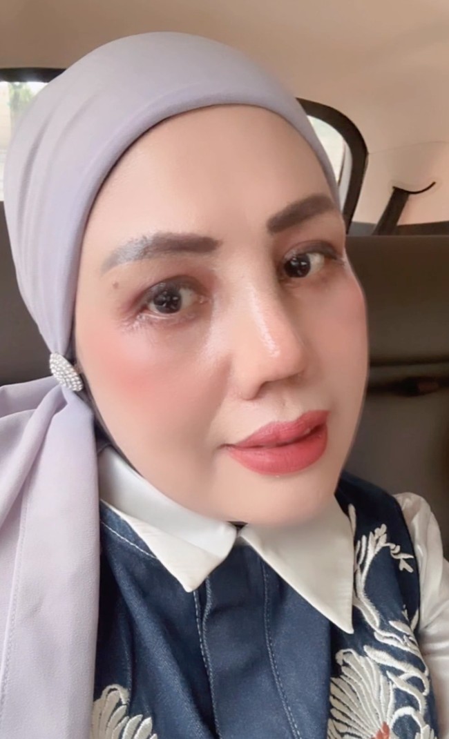 Kini sudah lepas perban, terlihat jelas perubahan pada hidung Elly. Hidungnya kini jadi jauh lebih mancung. Foto: Instagram/@ellysugigi_real