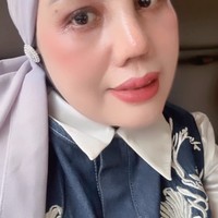 Kini sudah lepas perban, terlihat jelas perubahan pada hidung Elly. Hidungnya kini jadi jauh lebih mancung. Foto: Instagram/@ellysugigi_real