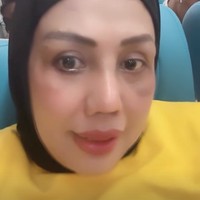 Setelah oplas hidung, Elly mengaku banyak netizen memintanya untuk juga merapikan bagian giginya. Aku orang yang selalu bersykur apa yang Allah berikan pada aku ..mohon maaf aku op idung hanya untuk perbaiki diri..bukan jual ..sekarang bqnyqk komen pada gigi ku di benerin juga .. tulis Elly dalam salah satu keterangan unggahannya. Foto: Instagram/@ellysugigi_real