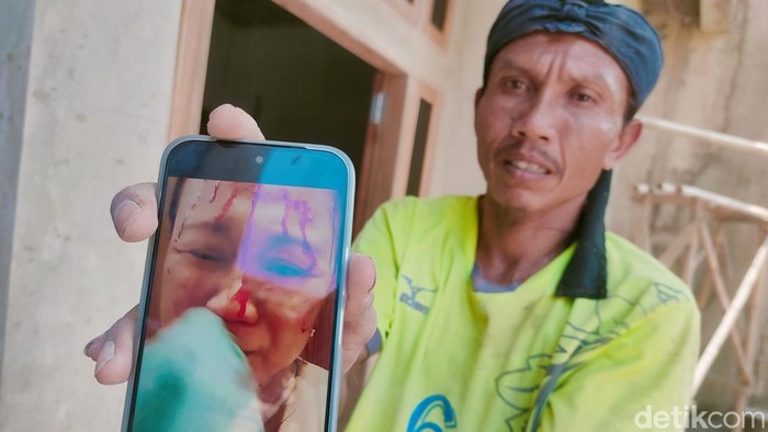PMI Ai bersimbah darah usai bekerja dalam keadaan sakit