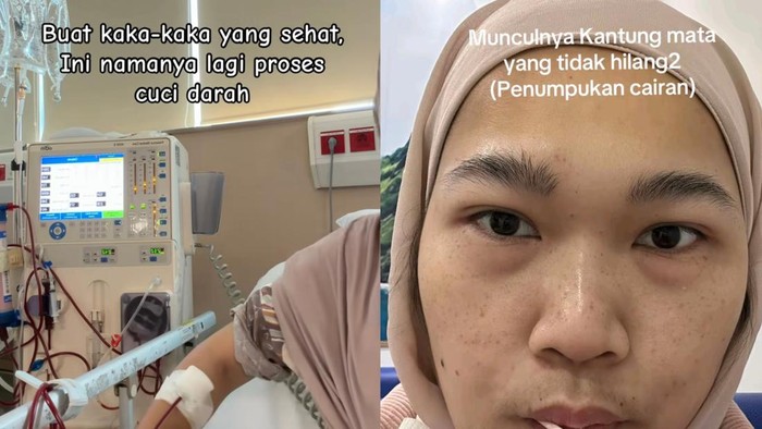Cuci darah