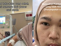 Viral Wanita Bekasi Cuci Darah karena Gagal Ginjal Stadium 5, Ini Gejala yang Dialami