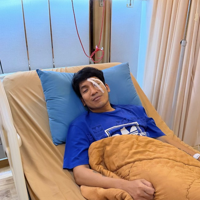 Desta Jalani Operasi Usai Mata Kena Bola Padel