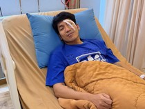Cerita Desta Jalani Operasi Penyedotan Darah usai Matanya Kena Bola Padel