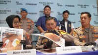 Bocah di Bekasi Dianiaya Ibu Tiri saat Ditinggal Ayah Kerja di Luar Negeri