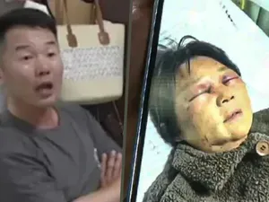 Tak Mau Urus Cucu, Menantu Ini Aniaya Mertua Hingga Patah Tulang Rusuk