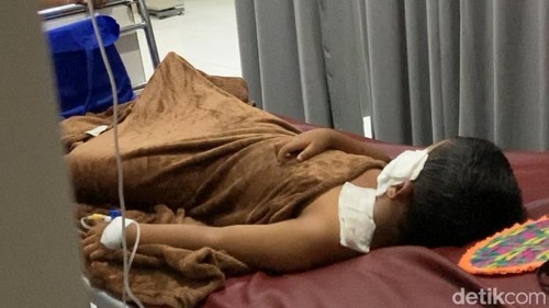 Salah seorang korban ledakan balon gas di Klungkung, tengah menjalani perawatan intensif di IGD RSUD Klungkung, Minggu, (19/7/2026).