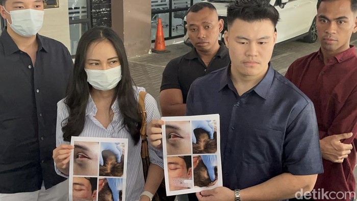Pengacara Mathew Jeremi bersama Fanny Agustin menunjukkan foto luka yang diderita korban usai dianiaya 3 pemuda di kelab malam Surabaya Barat