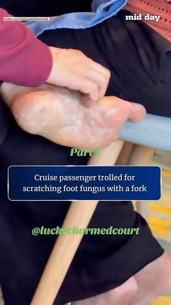 Jorok! Penumpang Kapal Pesiar Garuk Kaki Pakai Garpu Sambil Makan