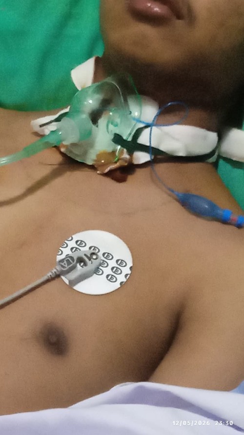 Warga Jembrana inisial HRS (20) dirawat di RSUP Prof Ngurah, Denpasar, akibat terjerat kabel WifI hingga pita suara robek. (Dok. DPRD Jembrana)